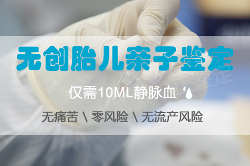 济南孕期亲子鉴定在哪里, 济南孕期亲子鉴定在哪里,