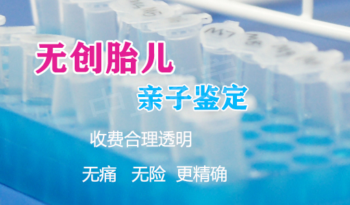 济南孕期亲子鉴定在哪里, 济南孕期亲子鉴定在哪里,